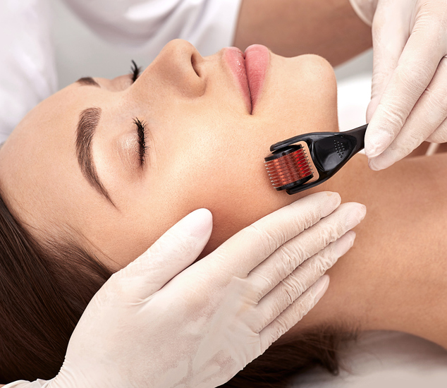 Micro derma facial roller. Brunette woman having derma roller treatment for improving surface skin
